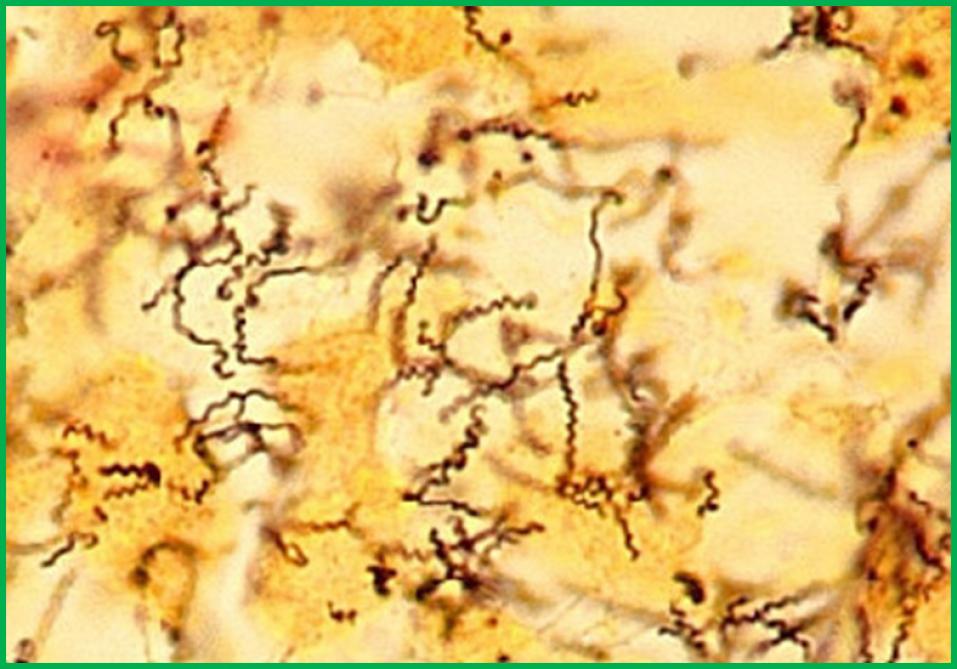 Vast staat dat spiraalvormige  Treponema bacteriën één van de primaire oorzaken zijn van digitale dermatitis of Mortellaro.