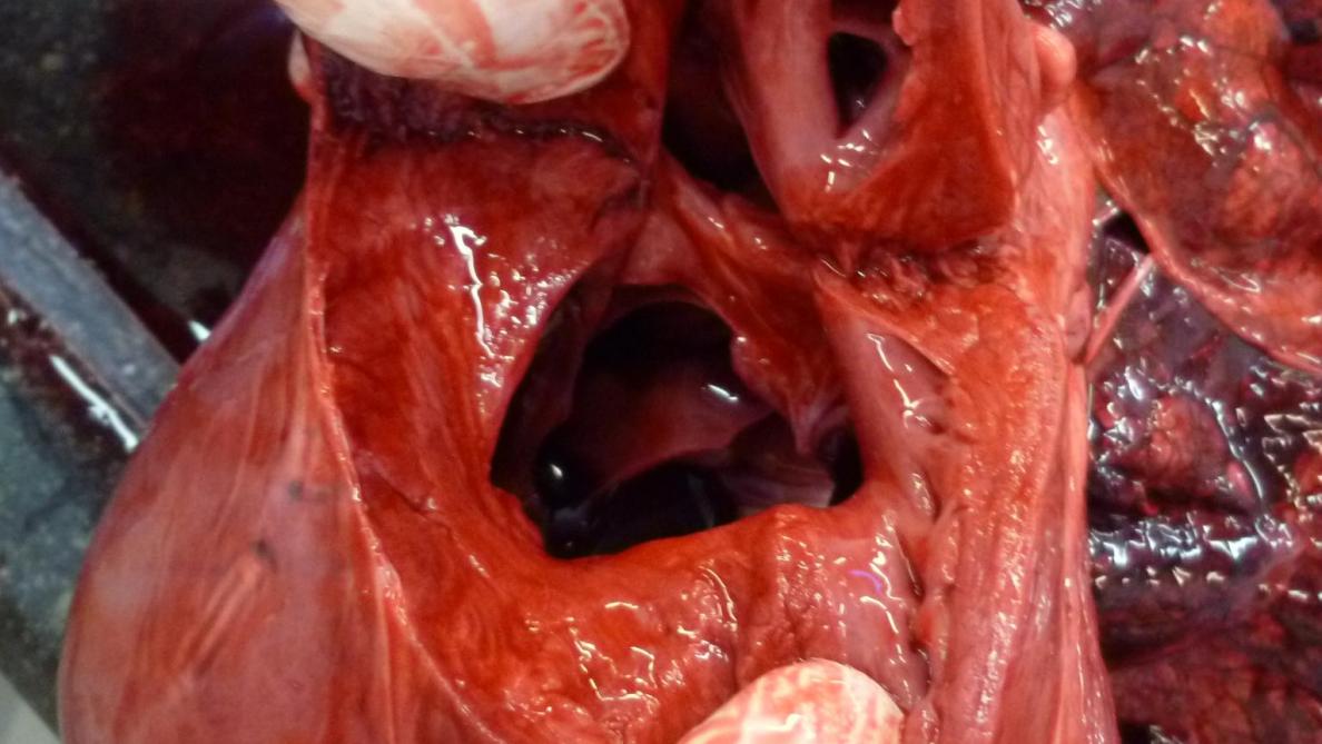 Foto 1: Aangeboren hartafwijking waarbij er een gaatje zit in het tussenschot tussen twee hartkamers.