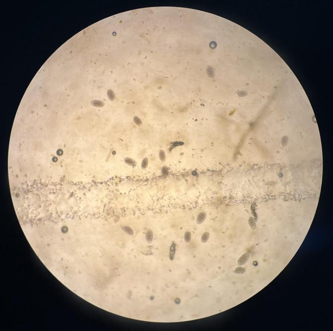 Strongyliden-eieren onder de microscoop met de Flotac-methode.