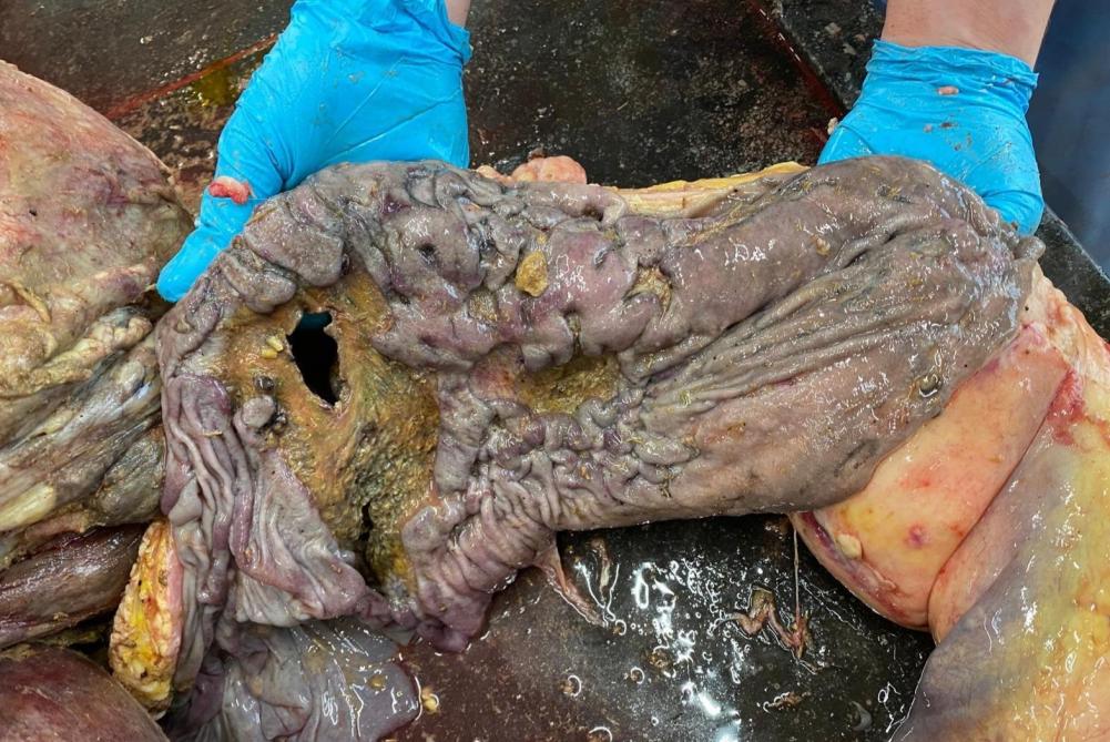 Perforerende lebmaagulcus met algemene peritonitis, type 4, bij een volwassen rund.