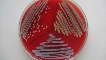 In de laatste jaren, dankzij de opkomst van betere laboratoriumtechnieken, is men erachter gekomen dat sommige CNS-soorten toch niet zo onschuldig blijken  te zijn.