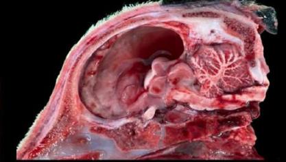 Schedelhelft van een runderfoetus met hydranencephalie.