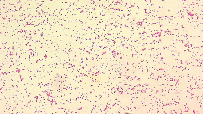 Brucellose (bij mensen Maltakoorts) is een infectieziekte bij zoogdieren. De brucella-bacterie wordt door besmette dieren uitgescheiden in melk, urine, ontlasting en vruchtwater.