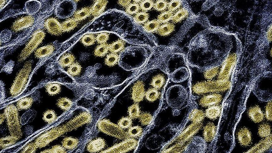 Een ingekleurde transmissie-elektronenmicrofoto van de vogelgriep afkomstig van de CDC en NIAID, Amerikaanse ziektebestrijdingsinstituten.
